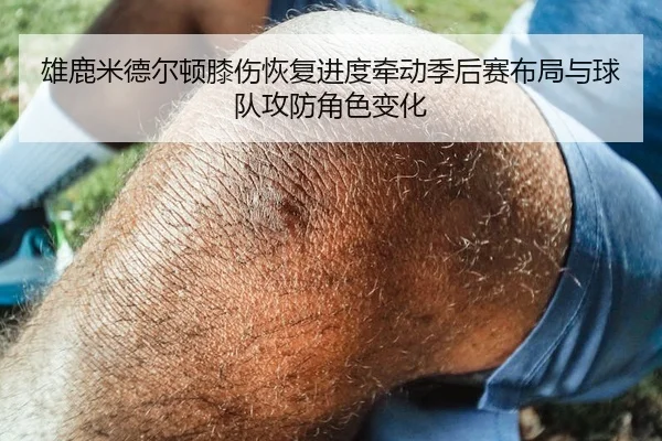 雄鹿米德尔顿膝伤恢复进度牵动季后赛布局与球队攻防角色变化 | kaiyun